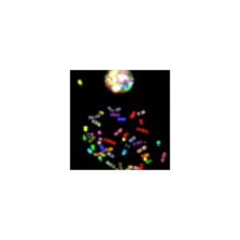 mfp-d415-xx