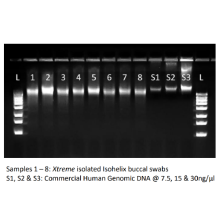 xme-xtreme-dna-isolation-kit-results